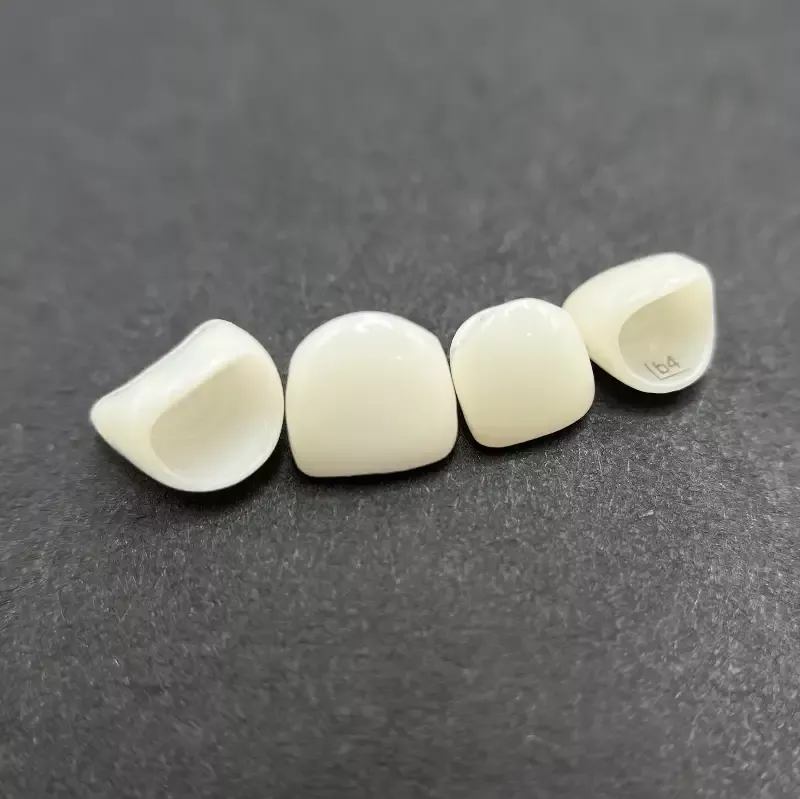 KTR Upper Right Incisor Size 2 Slim Fit Zirconia